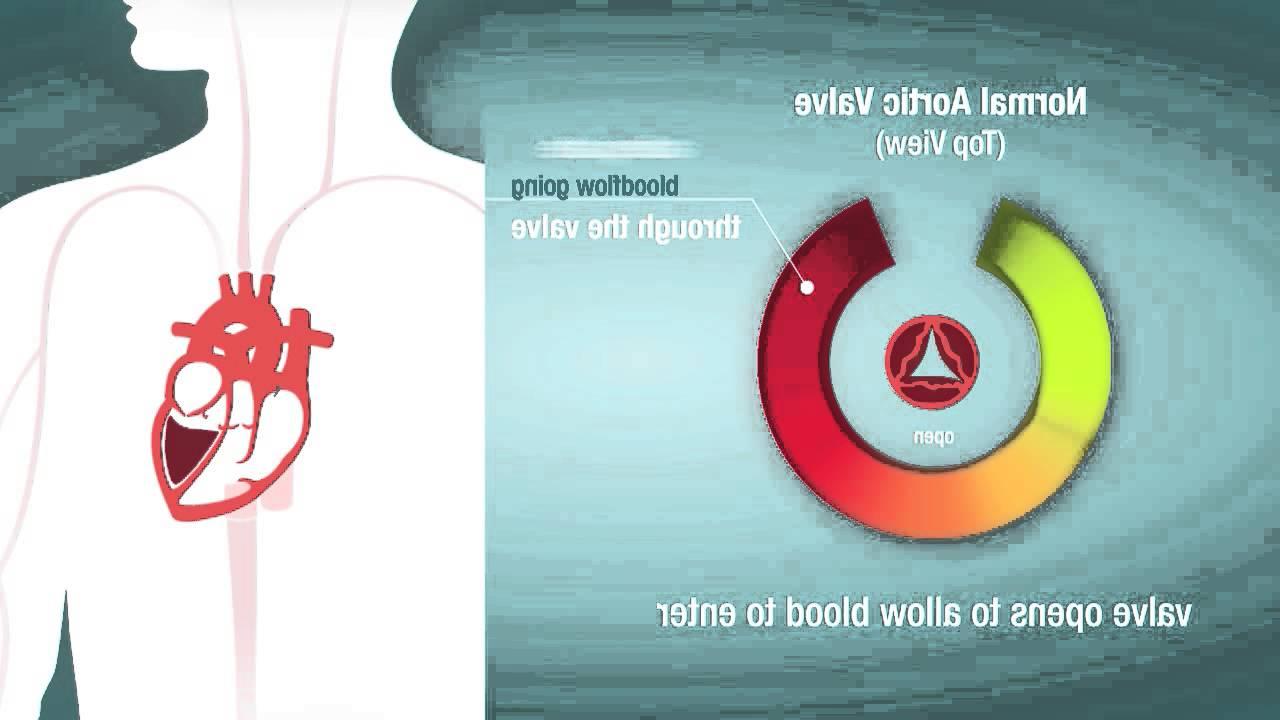 Heart Valve Stenosis video screenshot